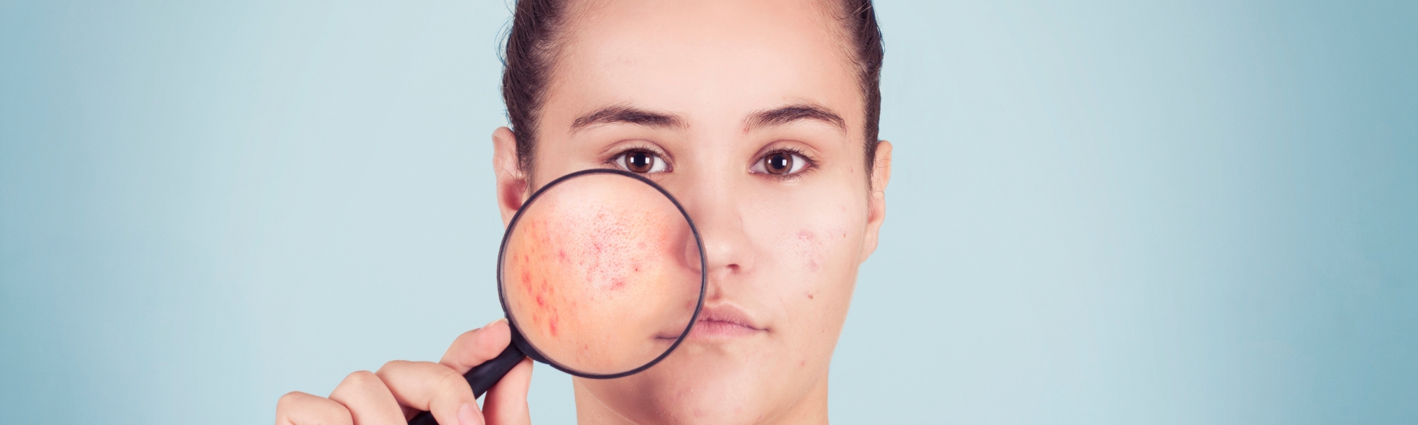 Tips Makeup Aman untuk Kulit Berjerawat: Tetap Tampil Percaya Diri!